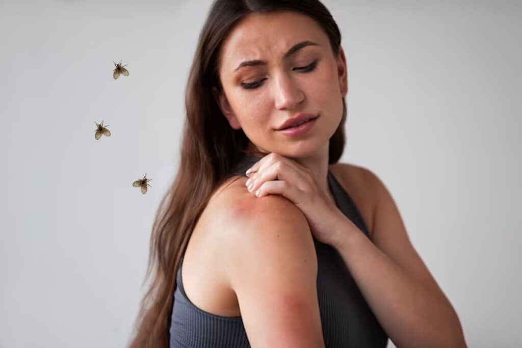 why some people get bitten by mosquitoes and not others